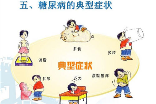 糖尿病早期症状有哪些 五大症状不可忽视