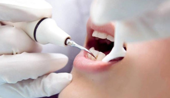 有什么有效的土方法可以医治牙龈肿痛？注意个人卫生