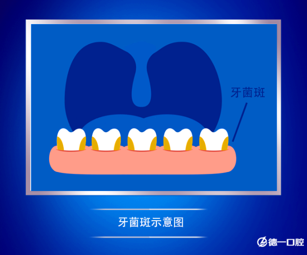 牙龈肿痛怎么办?史上最全的牙龈肿痛科普文章!很多因素引起