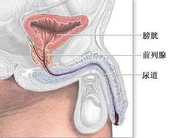 男士前列腺炎一般有哪些症状？这是前列腺炎吗？