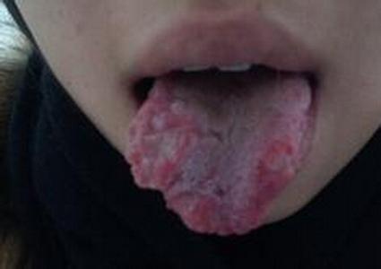 艾滋病!艾滋病是一种危害性极大的传染病