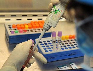 最常见的艾滋病初期症状 只有进行科学的艾滋病检测