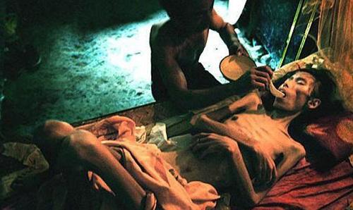 女性艾滋病初期症状!艾滋病初期症状是什么?