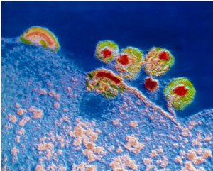 男性感染艾滋病的三大初期症状及最佳检测时间