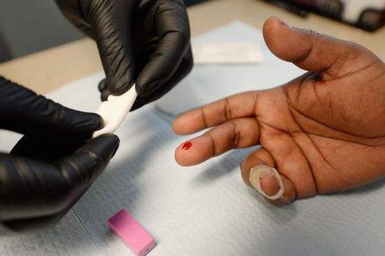 小儿艾滋病初期症状 甚至危及生命危险