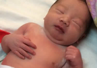 想顺产不要侧切行不行？为什么女人都怕顺产侧切