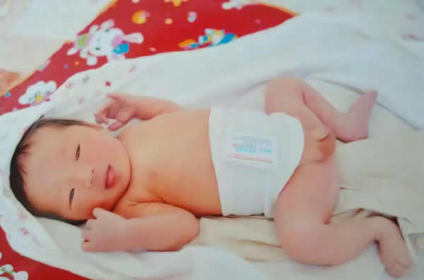 侧切伤口怎么护理？侧切会影响性生活吗