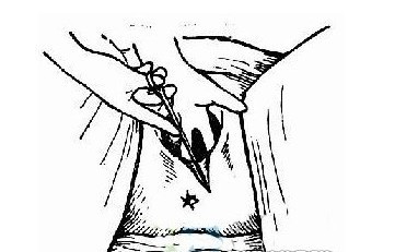 女人顺产侧切全过程（图片） 顺产侧切究竟是怎么一回事呢？